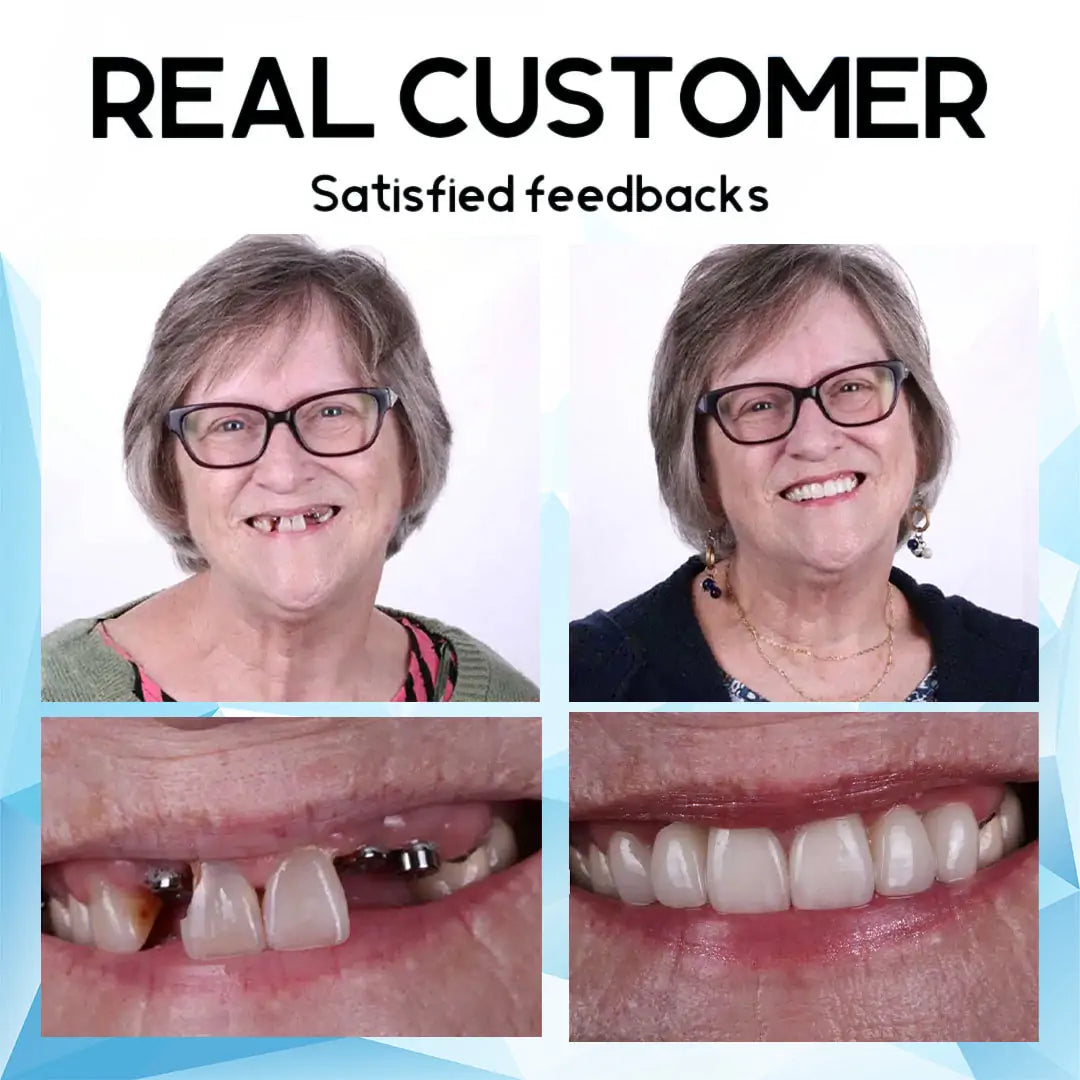 🦷 QIAWI™-Premium Custom Silicone Denture Set 👨‍⚕️ American Dental Association (ADA) certified
