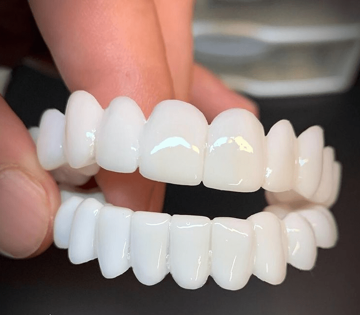 FLEXIDENT – Natural-Look Dental Veneer for Everyday Confidence
