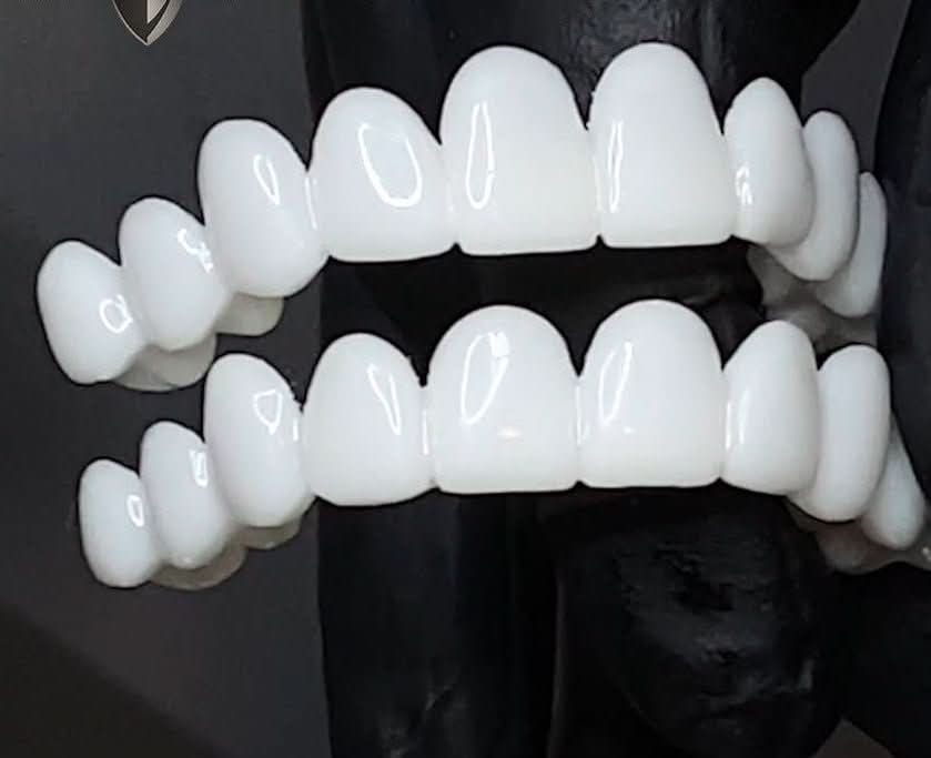 FLEXIDENT – Natural-Look Dental Veneer for Everyday Confidence